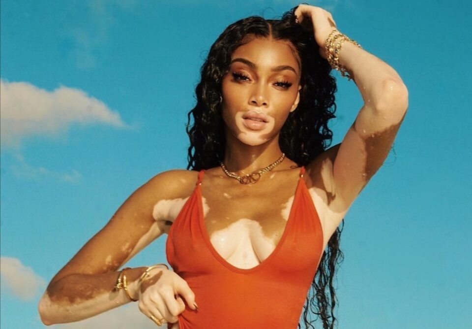 Winnie Harlow lancia la sua prima linea beauty